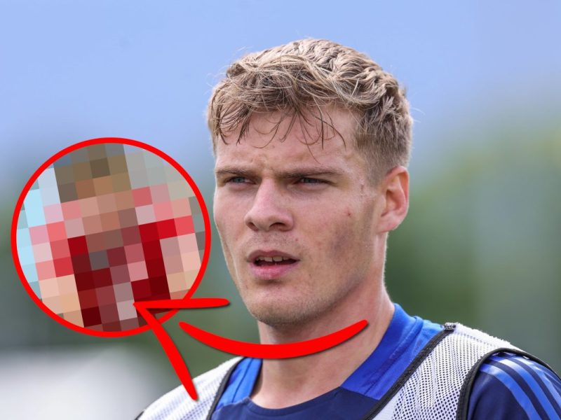 FC Schalke 04: Doppelte Hojlund-Power.